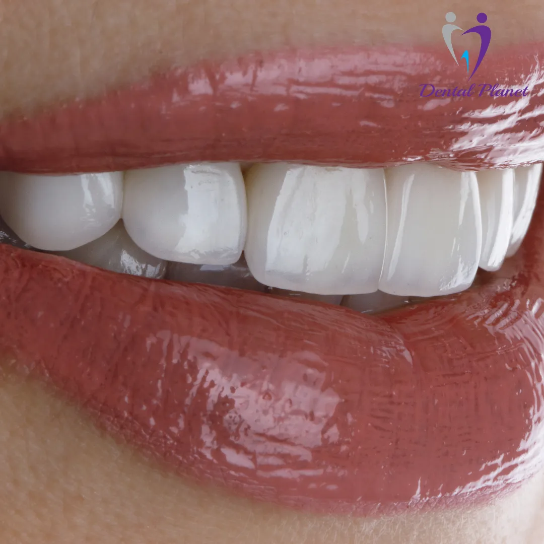 Best Dentist in Mysore